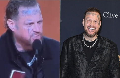 Jelly Roll Slammed Online For “Religious Psychosis” During Grammys Speech As His Dramatic Weight Loss Sparks Concern