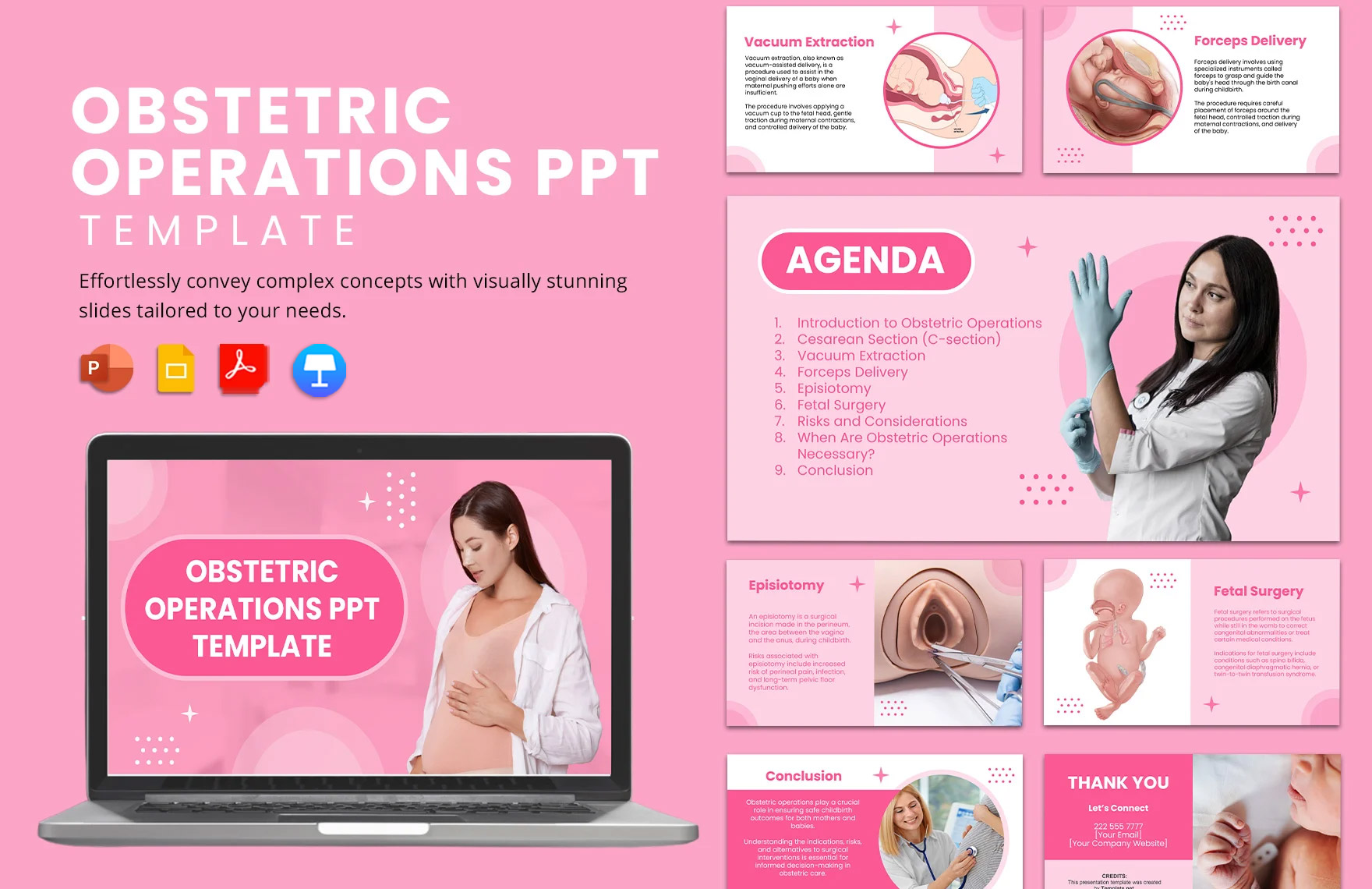 Obstetric Operations PPT Template Obstetric Operations PPT Template