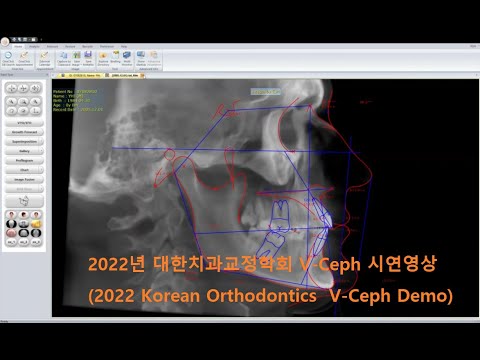 V-Ceph v8.5 Software