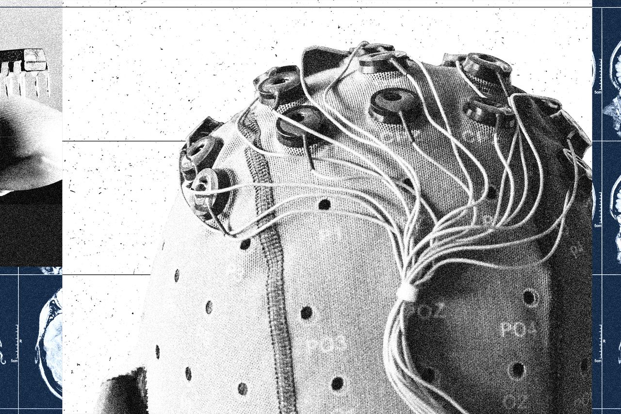 China Is Building a Brain-Computer Interface Industry