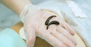 Ancient Leeches Weren't Bloodsuckers—They Were Way Creepier